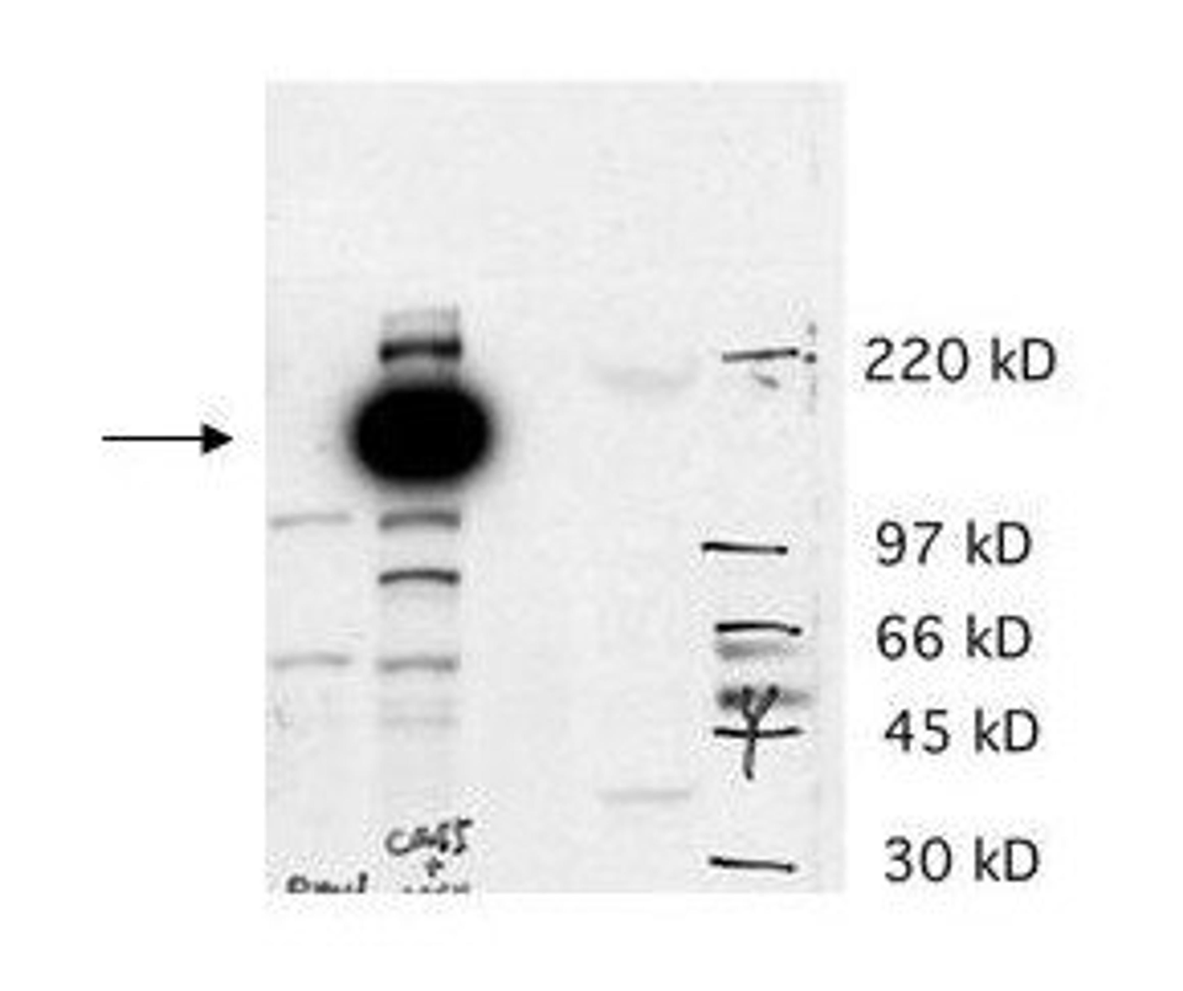 Western blot analysis of Lane 1 contains a lysate from AS cells transfected with empty vector. Lane 2 contains lysate from AS cells transfected with hCas5 (predicted MW 125 kDa). Lane 3 contains lysate from BE2 cells using Cas5 antibody