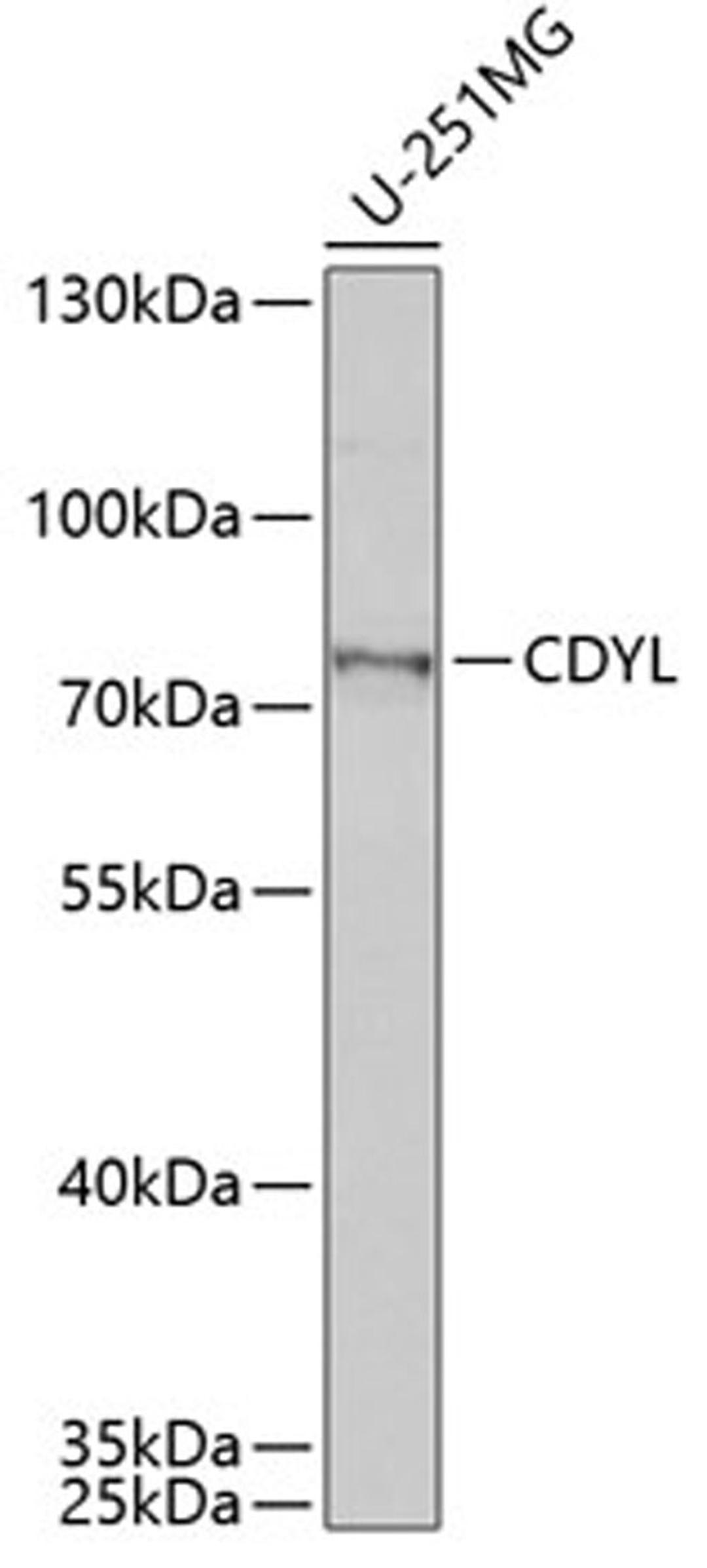 Western blot - CDYL antibody (A6258)