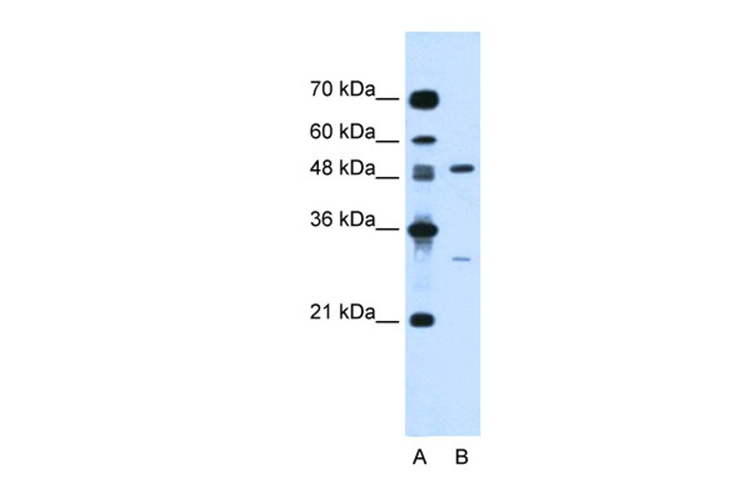 Antibody used in WB on Human Jurkat 0.2-1 ug/ml.