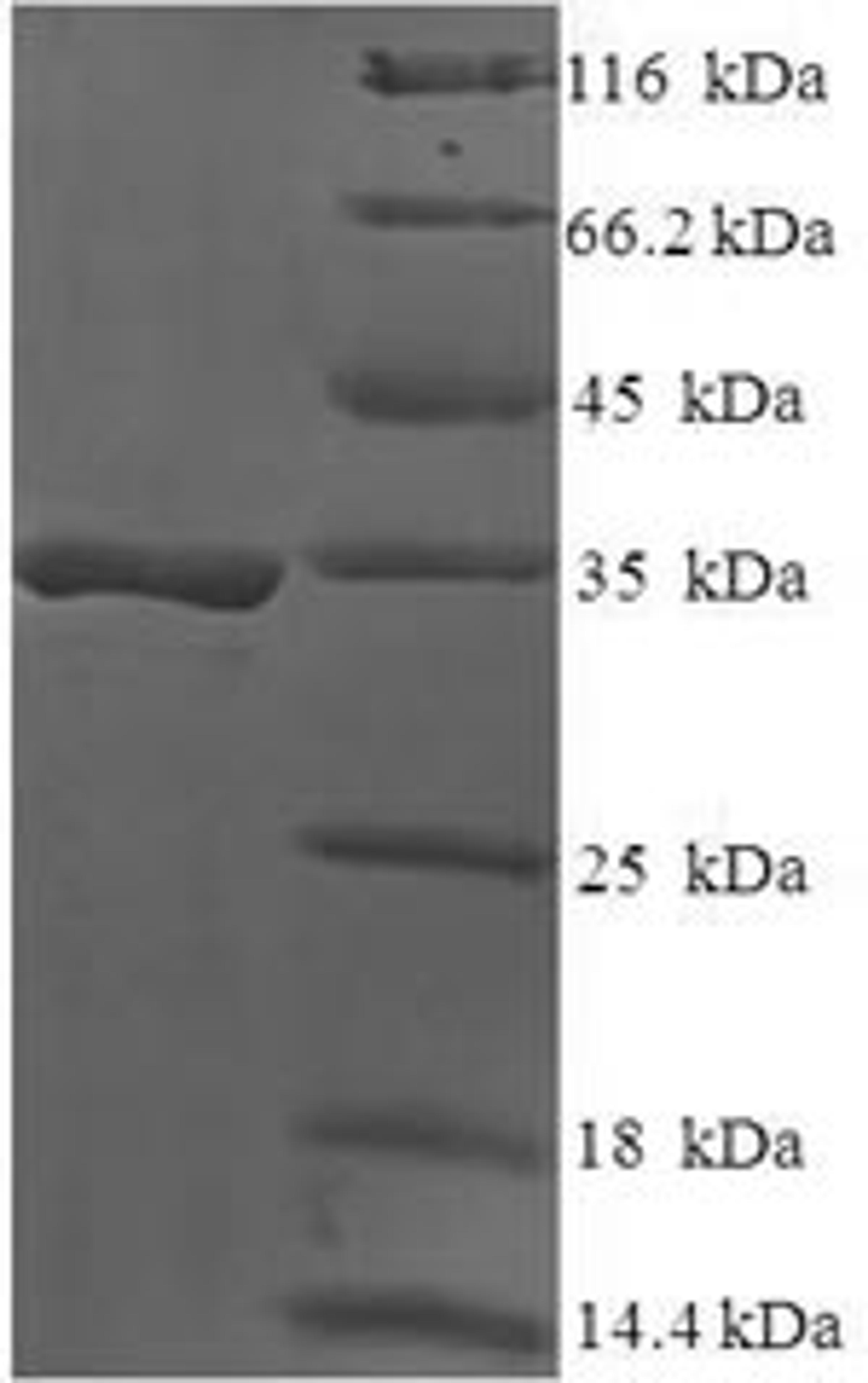 (Tris-Glycine gel) Discontinuous SDS-PAGE (reduced) with 5% enrichment gel and 15% separation gel.