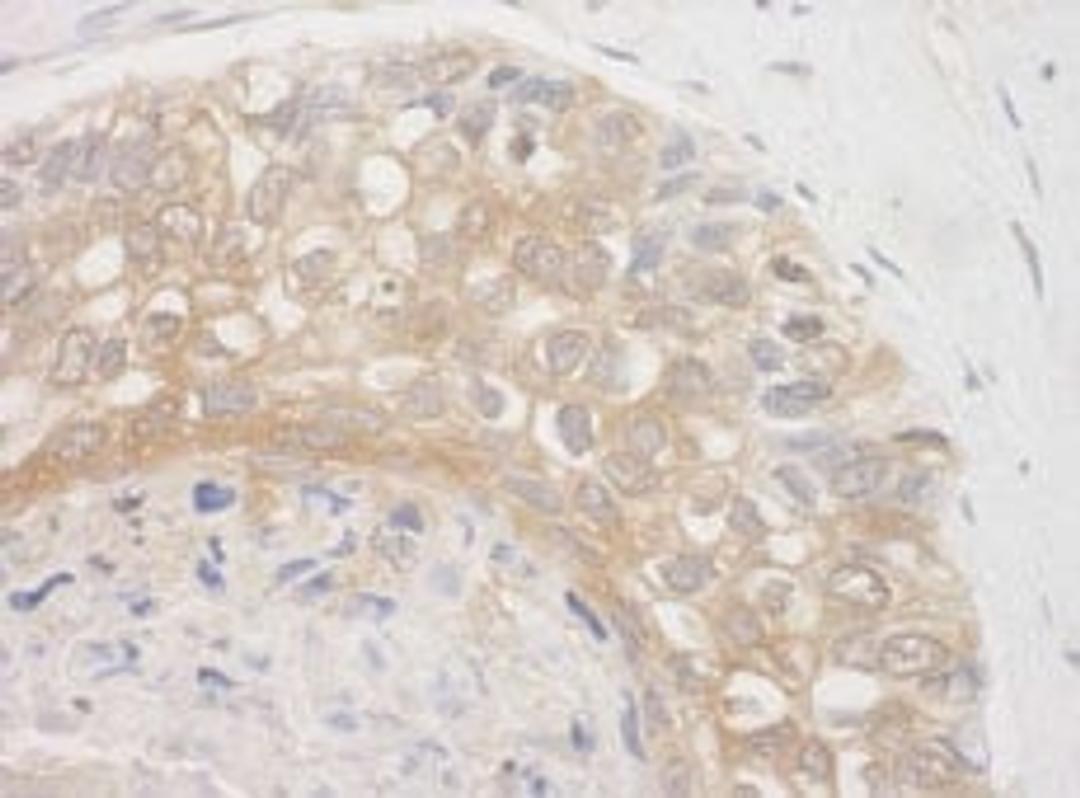 Detection of human BAG3 by immunohistochemistry.