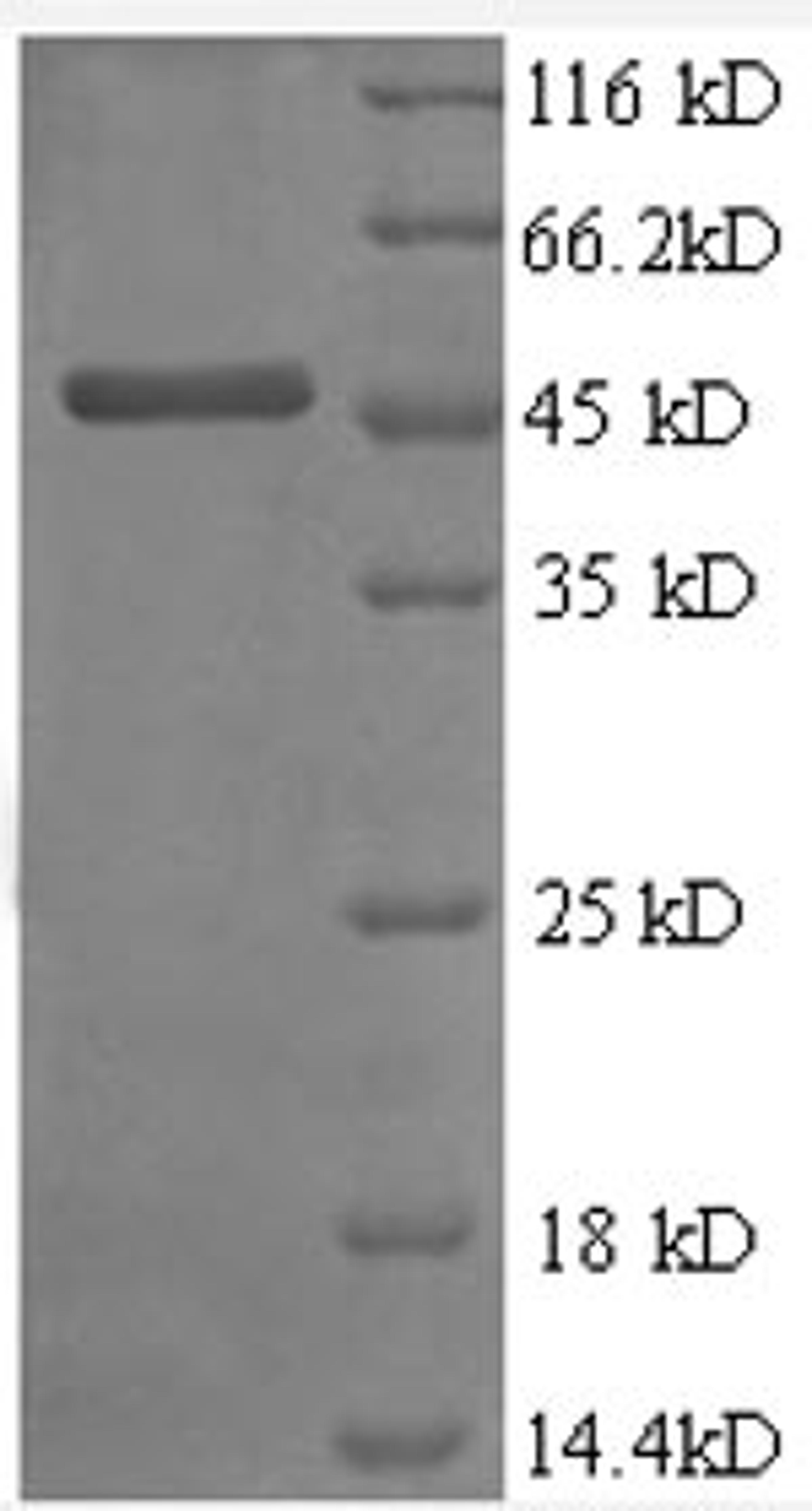 (Tris-Glycine gel) Discontinuous SDS-PAGE (reduced) with 5% enrichment gel and 15% separation gel.