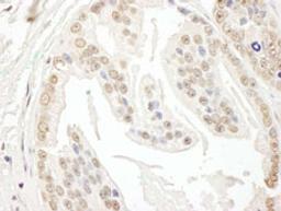 Detection of human POLR3D by immunohistochemistry.