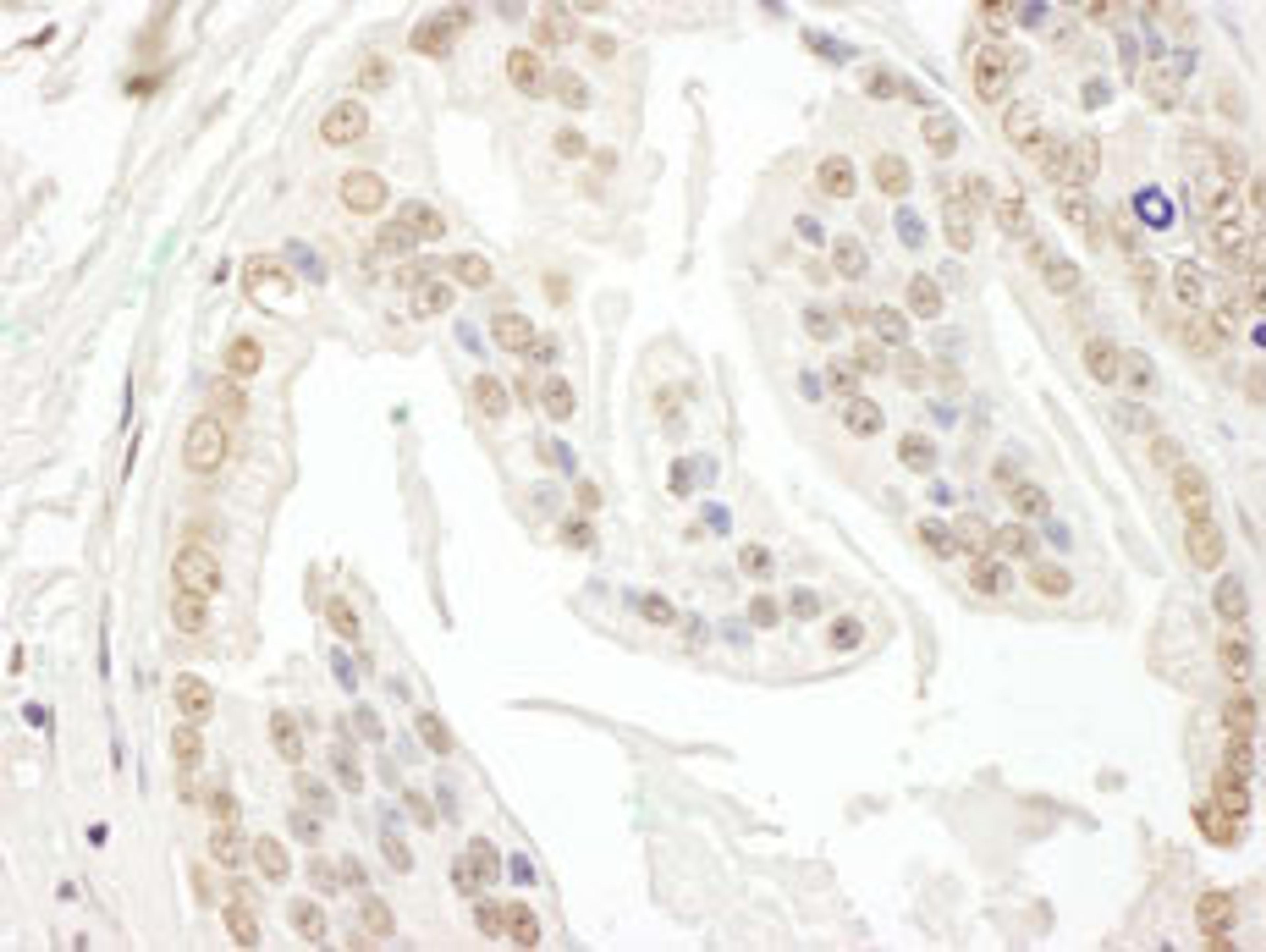 Detection of human POLR3D by immunohistochemistry.