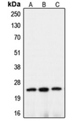 Western blot analysis of HEK293T (Lane 1), mouse brain (Lane 2), rat kidney (Lane 3) whole cell lysates using CLDN10 antibody