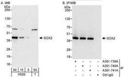 Detection of human SOX2 by western blot and immunoprecipitation.