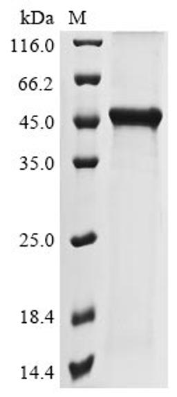 (Tris-Glycine gel) Discontinuous SDS-PAGE (reduced) with 5% enrichment gel and 15% separation gel.