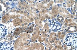 Antibody used in IHC on Human kidney.