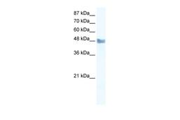 Antibody used in WB on Human Jurkat 2.5 ug/ml.