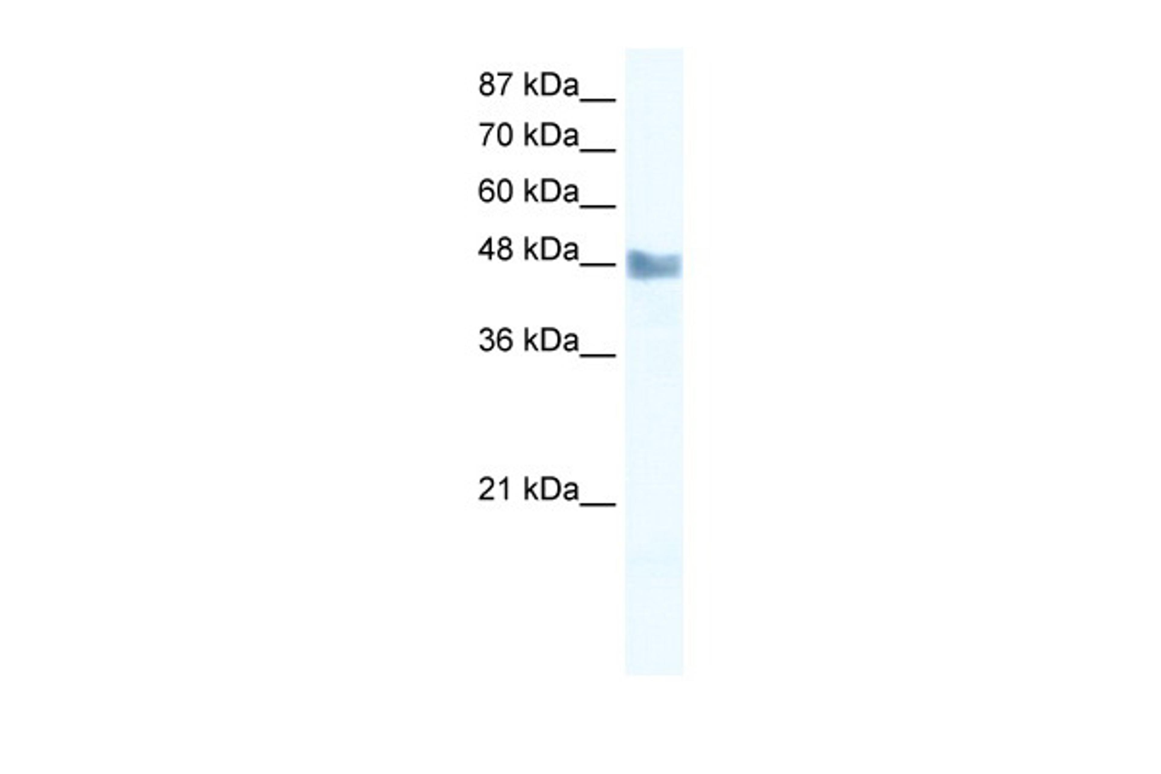 Antibody used in WB on Human Jurkat 2.5 ug/ml.