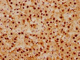 IHC image of CSB-RA022948A0HU diluted at 1:92.5 and staining in paraffin-embedded human adrenal gland tissue performed on a Leica BondTM system. After dewaxing and hydration, antigen retrieval was mediated by high pressure in a citrate buffer (pH 6.0). Section was blocked with 10% normal goat serum 30min at RT. Then primary antibody (1% BSA) was incubated at 4℃ overnight. The primary is detected by a biotinylated secondary antibody and visualized using an HRP conjugated SP system.