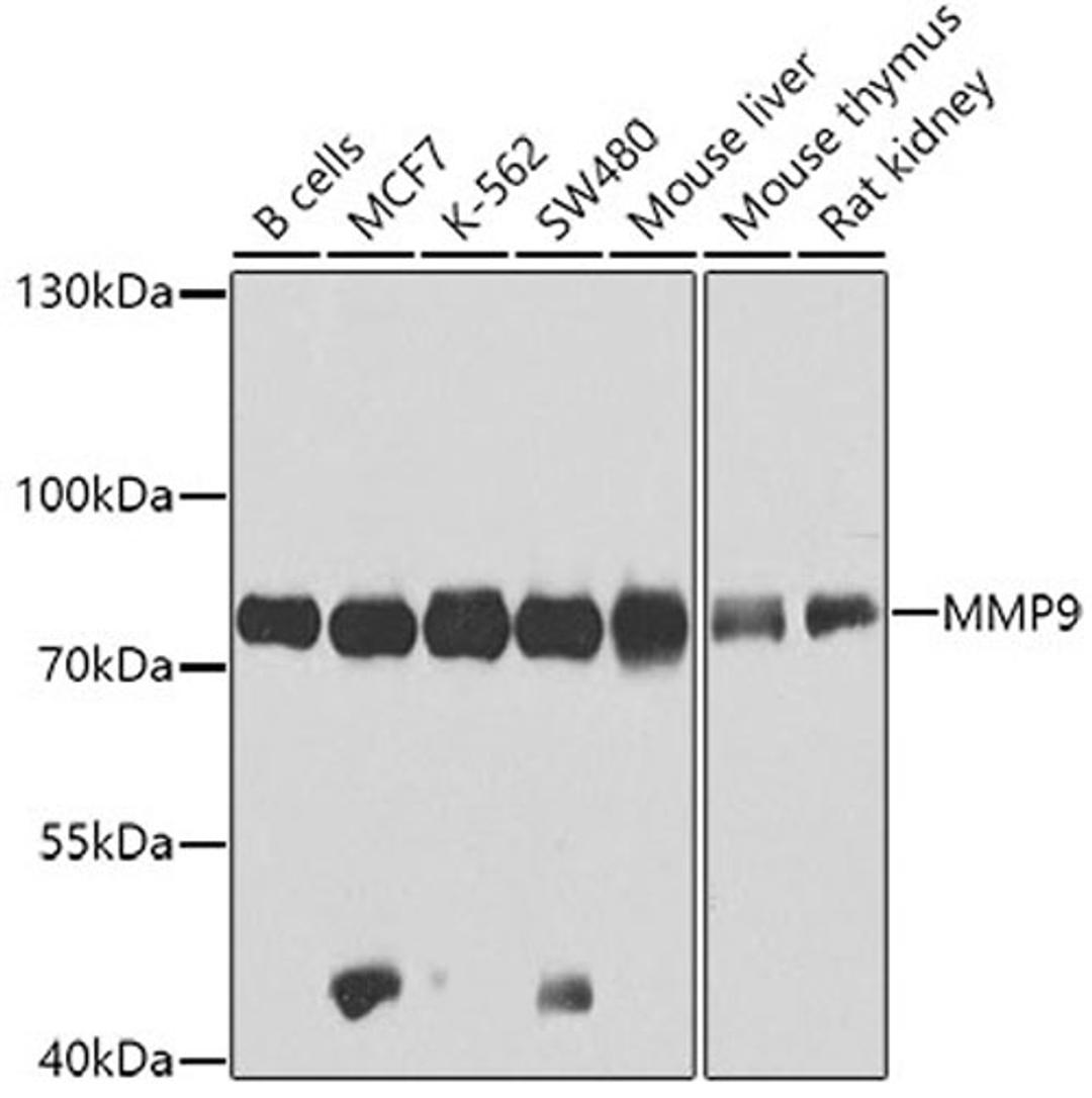 Western blot - MMP9 antibody (A0289)