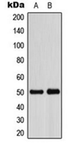 Western blot analysis of HeLa (Lane 1), VEC (Lane 2) whole cell lysates using ADPGK antibody