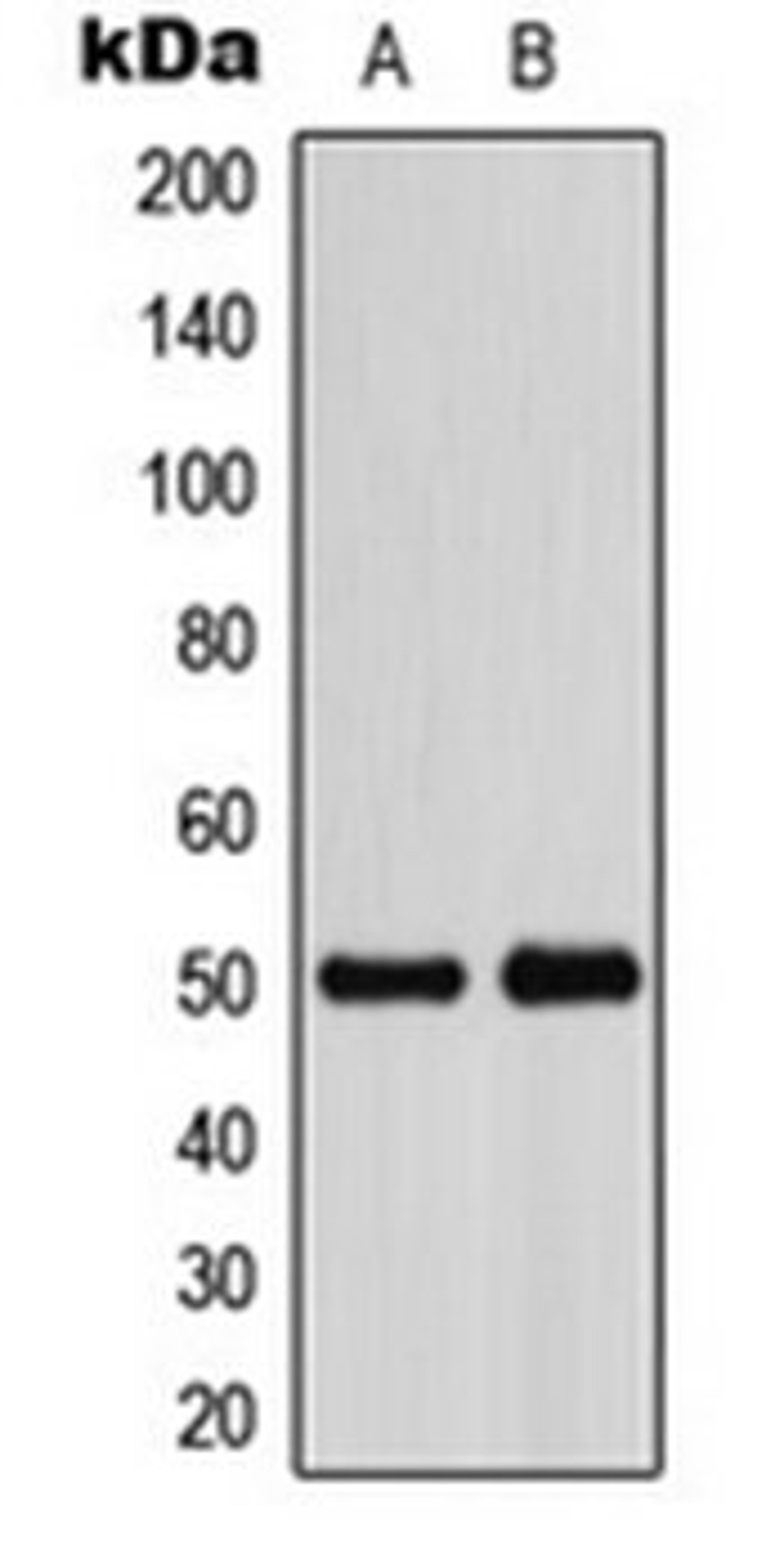 Western blot analysis of HeLa (Lane 1), VEC (Lane 2) whole cell lysates using ADPGK antibody