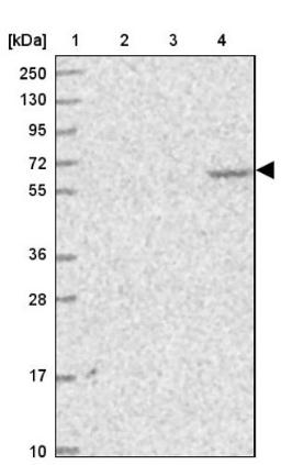 Western Blot: KLHL35 Antibody [NBP1-89837] - Lane 1: Marker [kDa] 250, 130, 95, 72, 55, 36, 28, 17, 10<br/>Lane 2: Human cell line RT-4<br/>Lane 3: Human cell line U-251MG sp<br/>Lane 4: Human plasma (IgG/HSA depleted)