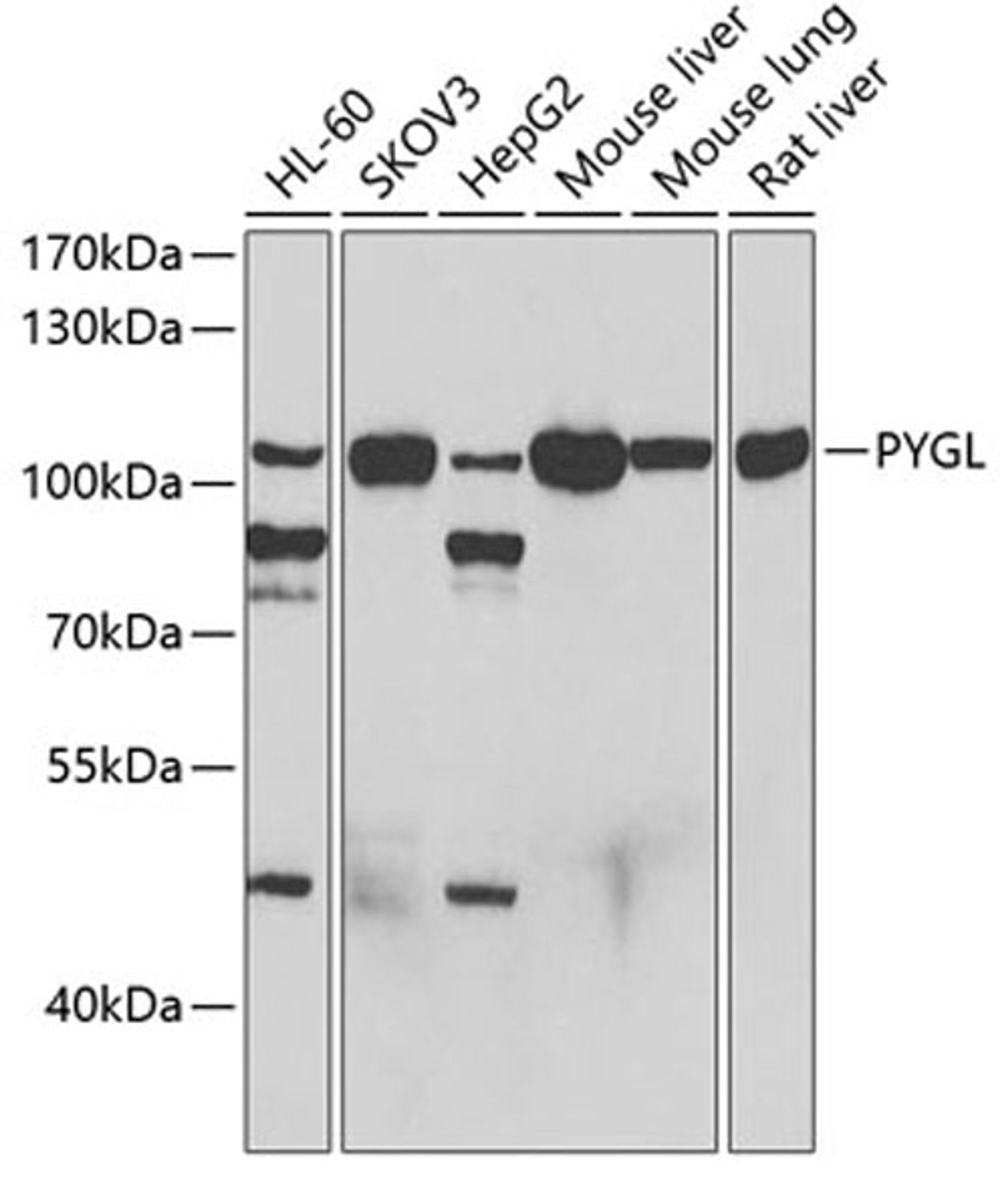 Western blot - PYGL antibody (A6710)