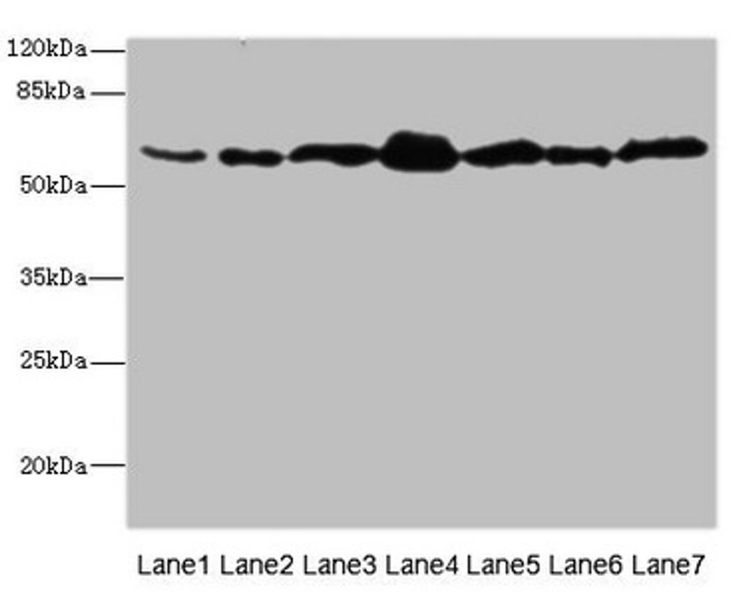 Western blot. All lanes: NAE1 antibody at 1.85µg/ml. Lane 1: Mouse liver tissue. Lane 2: Mouse kidney tissue. Lane 3: Mouse skeletal muscle tissue. Lane 4: 293T whole cell lysate. Lane 5: A431 whole cell lysate. Lane 6: K562 whole cell lysate. Lane 7: Hela whole cell lysate. Secondary. Goat polyclonal to rabbit IgG at 1/10000 dilution. Predicted band size: 61, 60, 51 kDa. Observed band size: 61 kDa