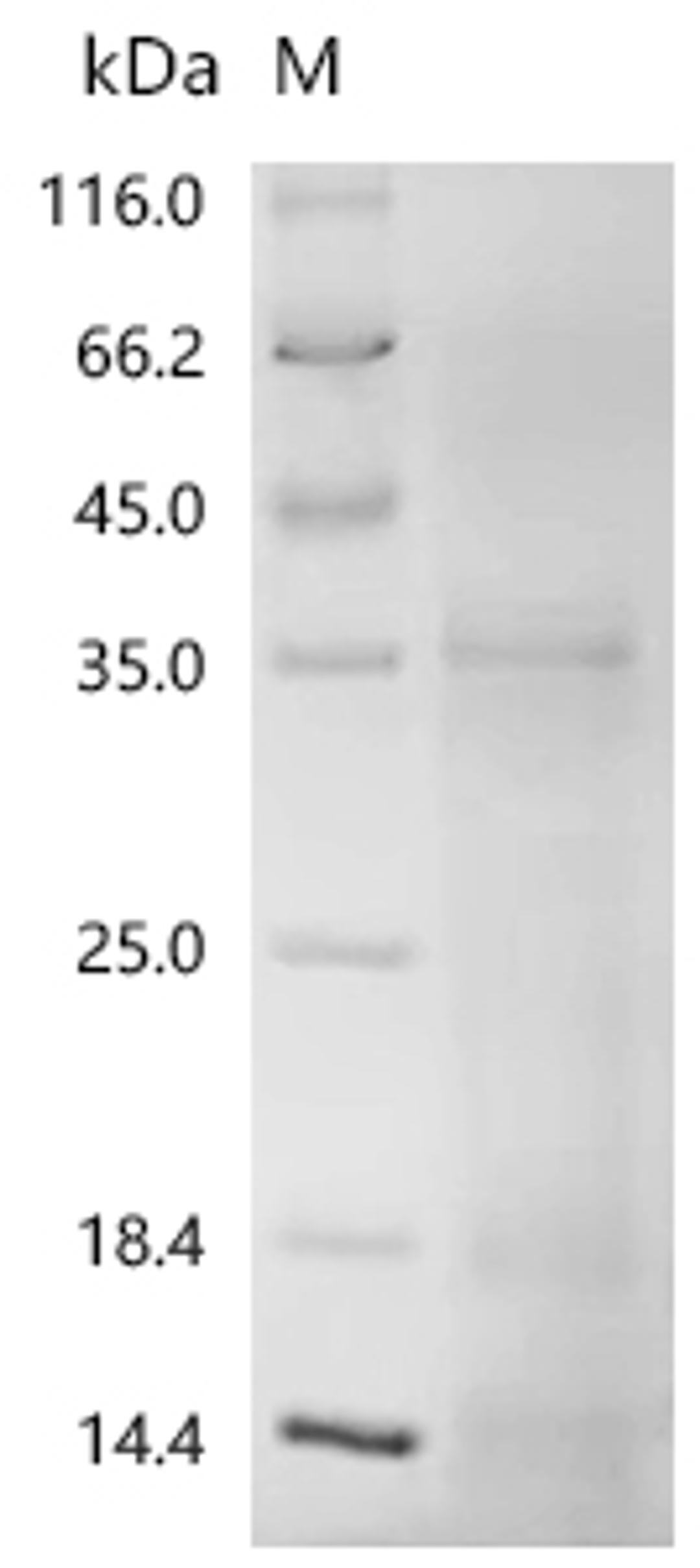 (Tris-Glycine gel) Discontinuous SDS-PAGE (reduced) with 5% enrichment gel and 15% separation gel.