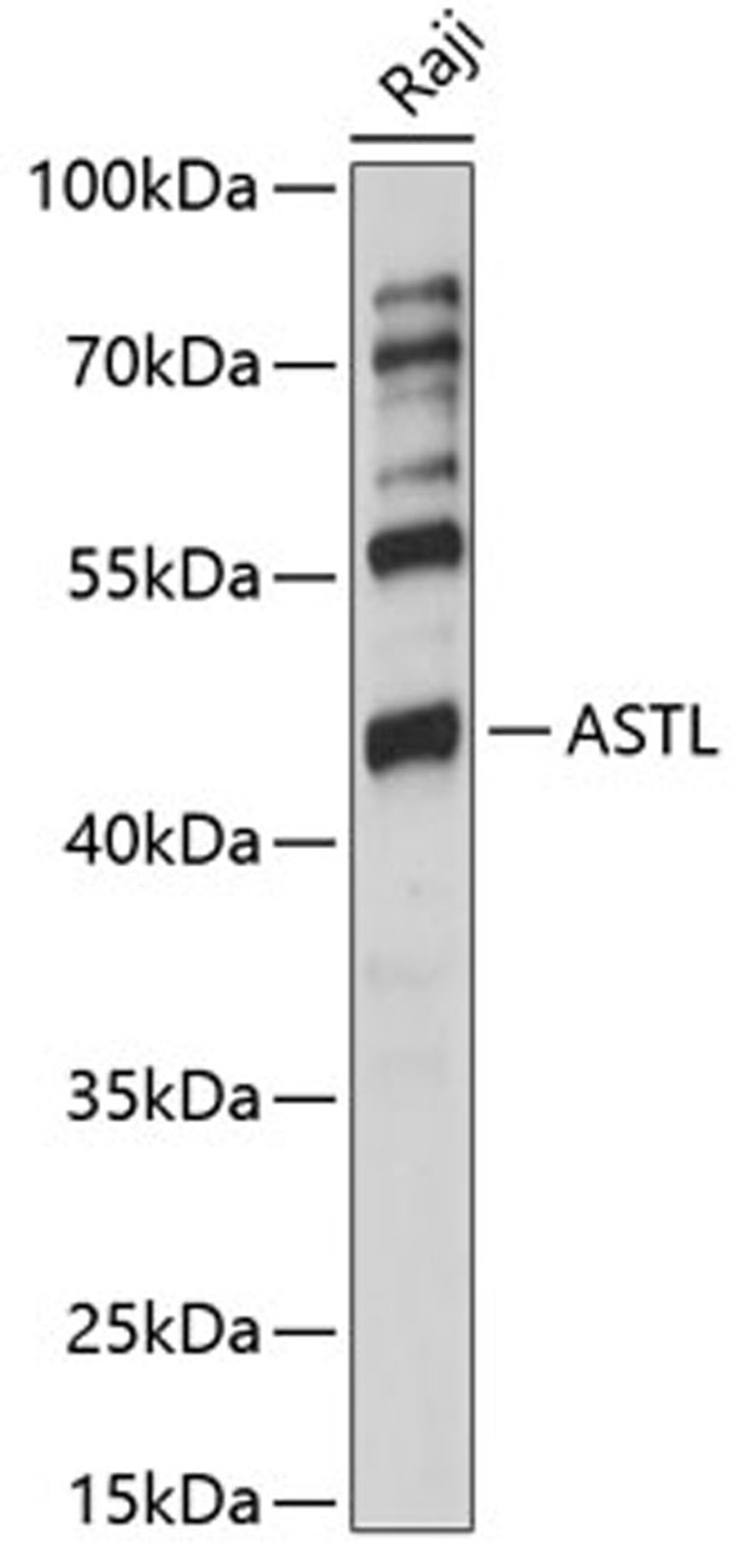 Western blot - ASTL antibody (A14984)