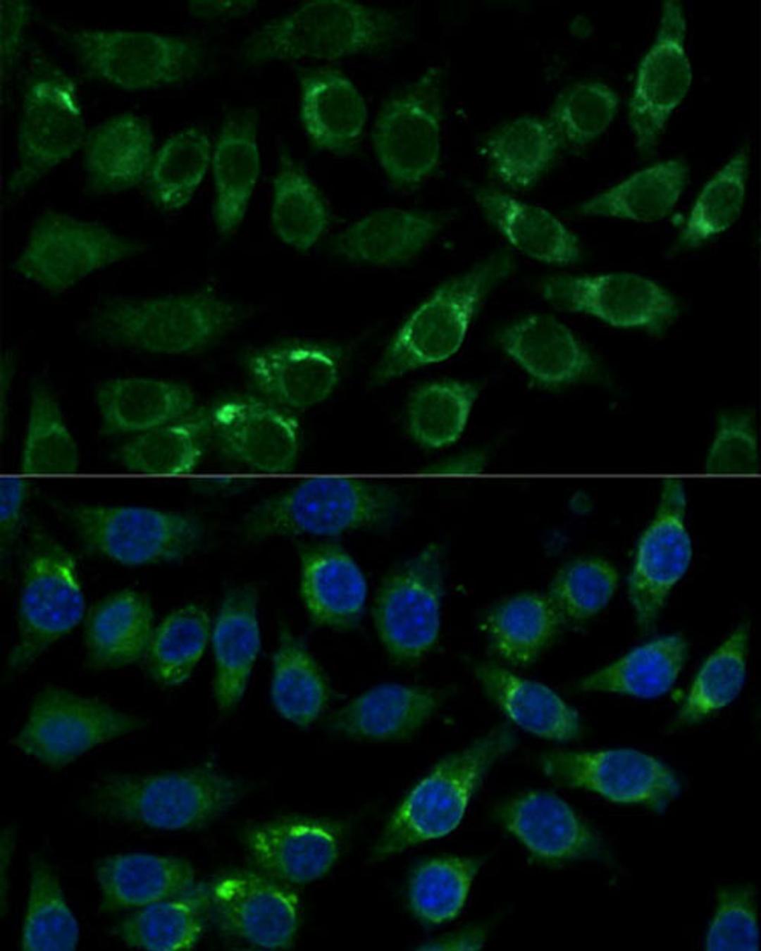 Immunofluorescence - ALDH3A2 Polyclonal Antibody (A16267)