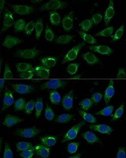 Immunofluorescence - ALDH3A2 Polyclonal Antibody (A16267)