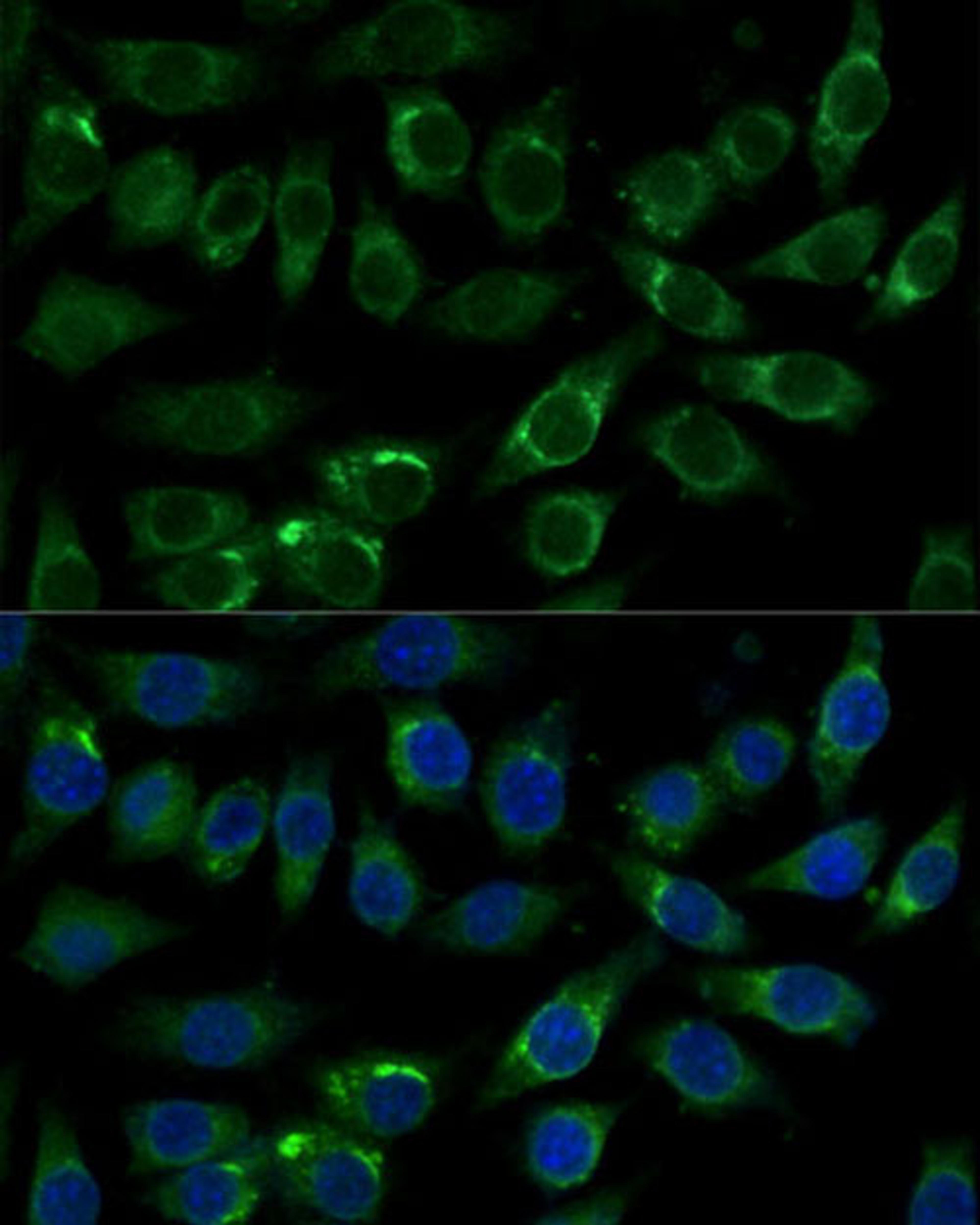 Immunofluorescence - ALDH3A2 Polyclonal Antibody (A16267)