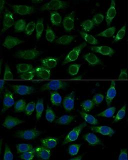 Immunofluorescence - ALDH3A2 Polyclonal Antibody (A16267)