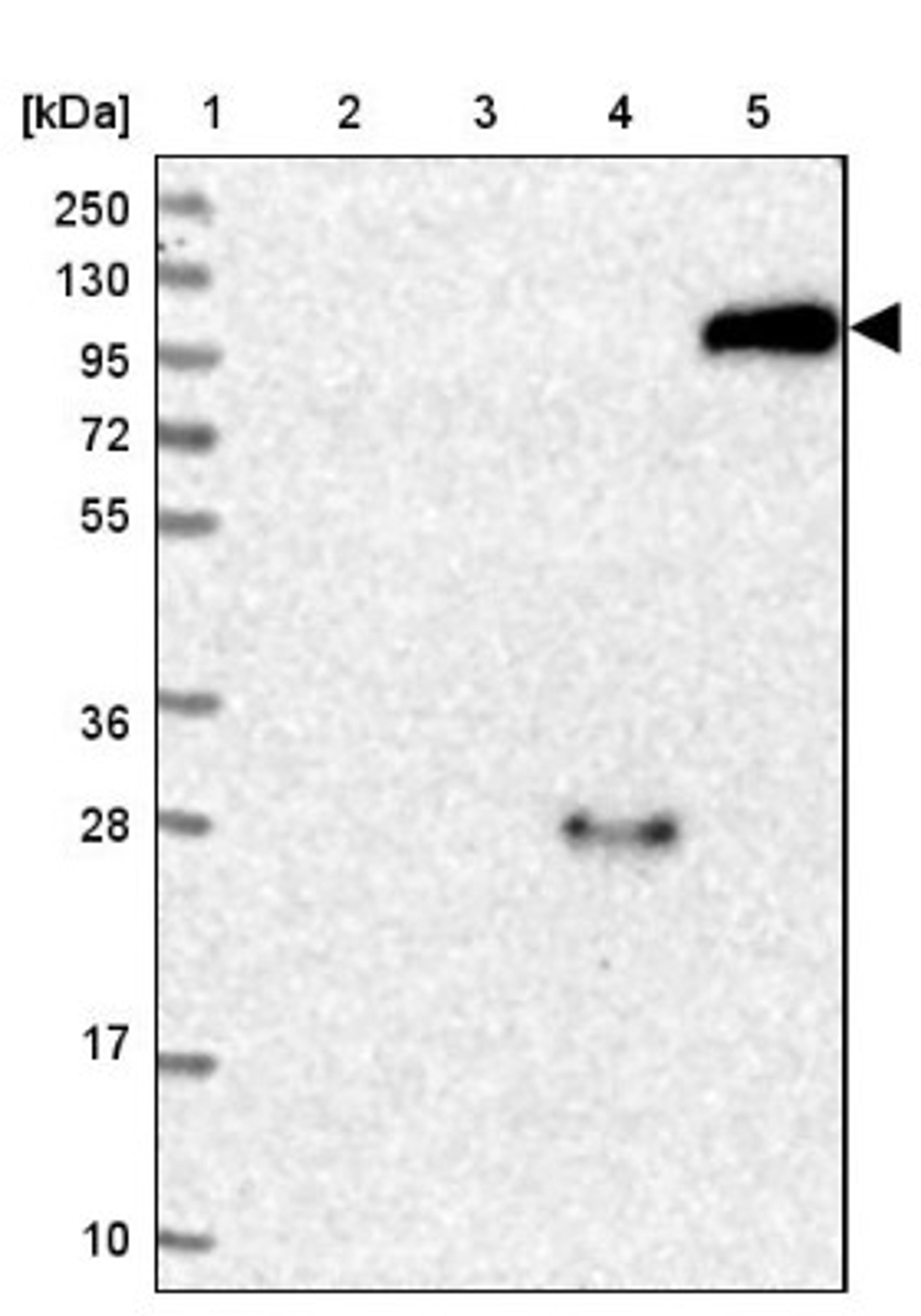 Western Blot: ATP8B3 Antibody [NBP2-31912] - Lane 1: Marker [kDa] 250, 130, 95, 72, 55, 36, 28, 17, 10<br/>Lane 2: Human cell line RT-4<br/>Lane 3: Human cell line U-251MG sp<br/>Lane 4: Human plasma (IgG/HSA depleted)<br/>Lane 5: Human liver tissue