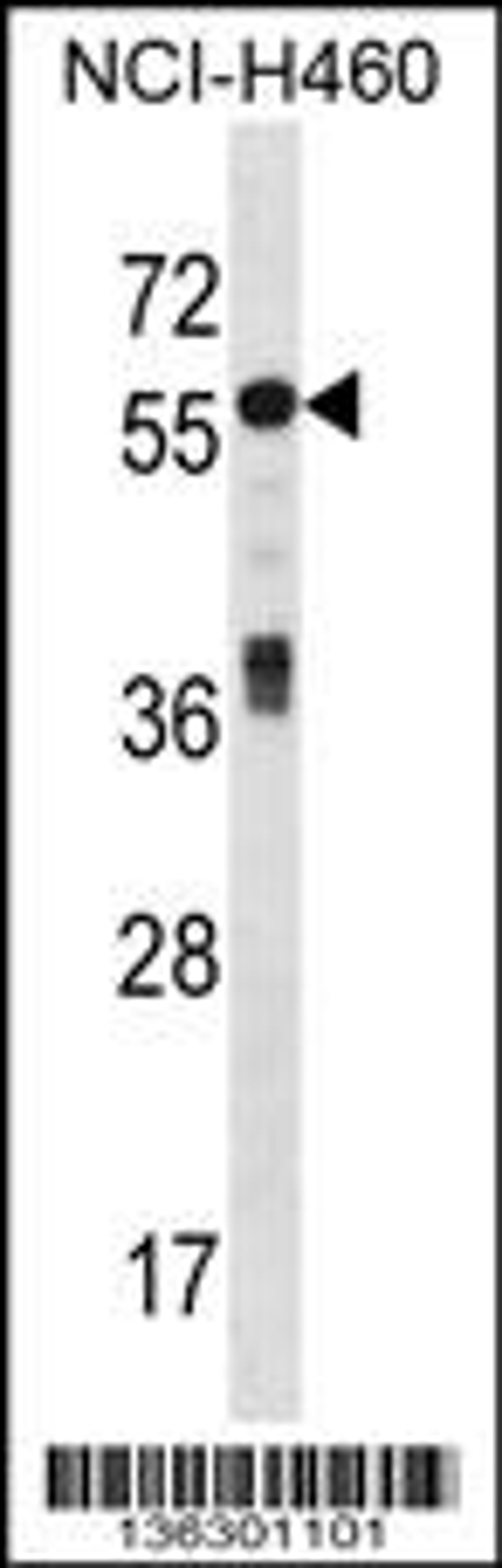 Western blot analysis in NCI-H460 cell line lysates (35ug/lane).