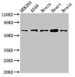 Western Blot. Positive WB detected in: HEK293 whole cell lysate, A549 whole cell lysate, Mouse brain tissue, Mouse heart tissue, Rat brain tissue. All lanes: PXK antibody at 2.7µg/ml. Secondary. Goat polyclonal to rabbit IgG at 1/50000 dilution. Predicted band size: 65, 59, 39, 63, 50, 61, 56 kDa. Observed band size: 65 kDa