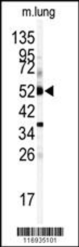 Western blot analysis of anti-CYP1A1 Antibody in mouse lung tissue lysates (35ug/lane)