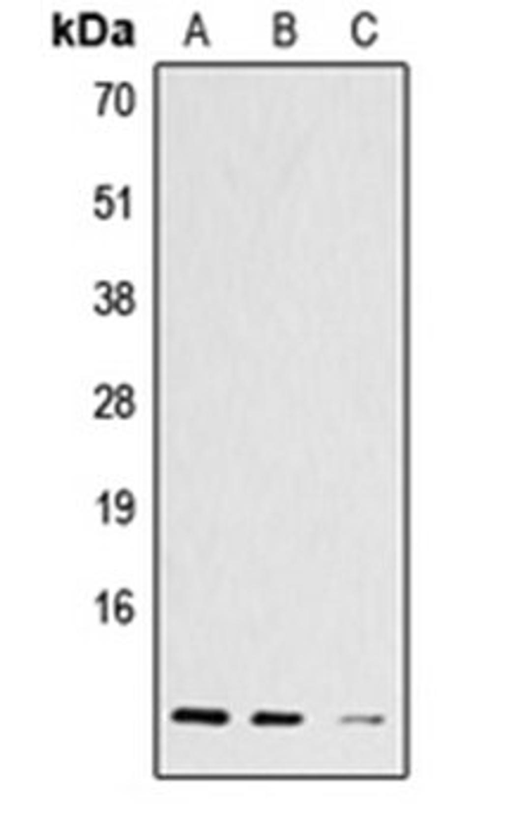 Western blot analysis of A431 (Lane 1), L929 (Lane 2), C6 (Lane 3) whole cell lysates using HIST1H4A antibody