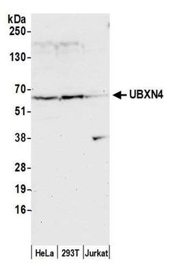 Detection of human UBXN4 by WB.