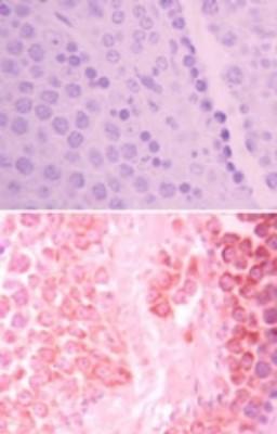 Immunohistochemistry-Paraffin: HIPK3 Antibody [NBP2-24521] - Analysis of HIPK3 in formalin-fixed, paraffin-embedded mouse testis tissue using an isotype control (top) and this antibody (bottom) at 5 ug/ml.