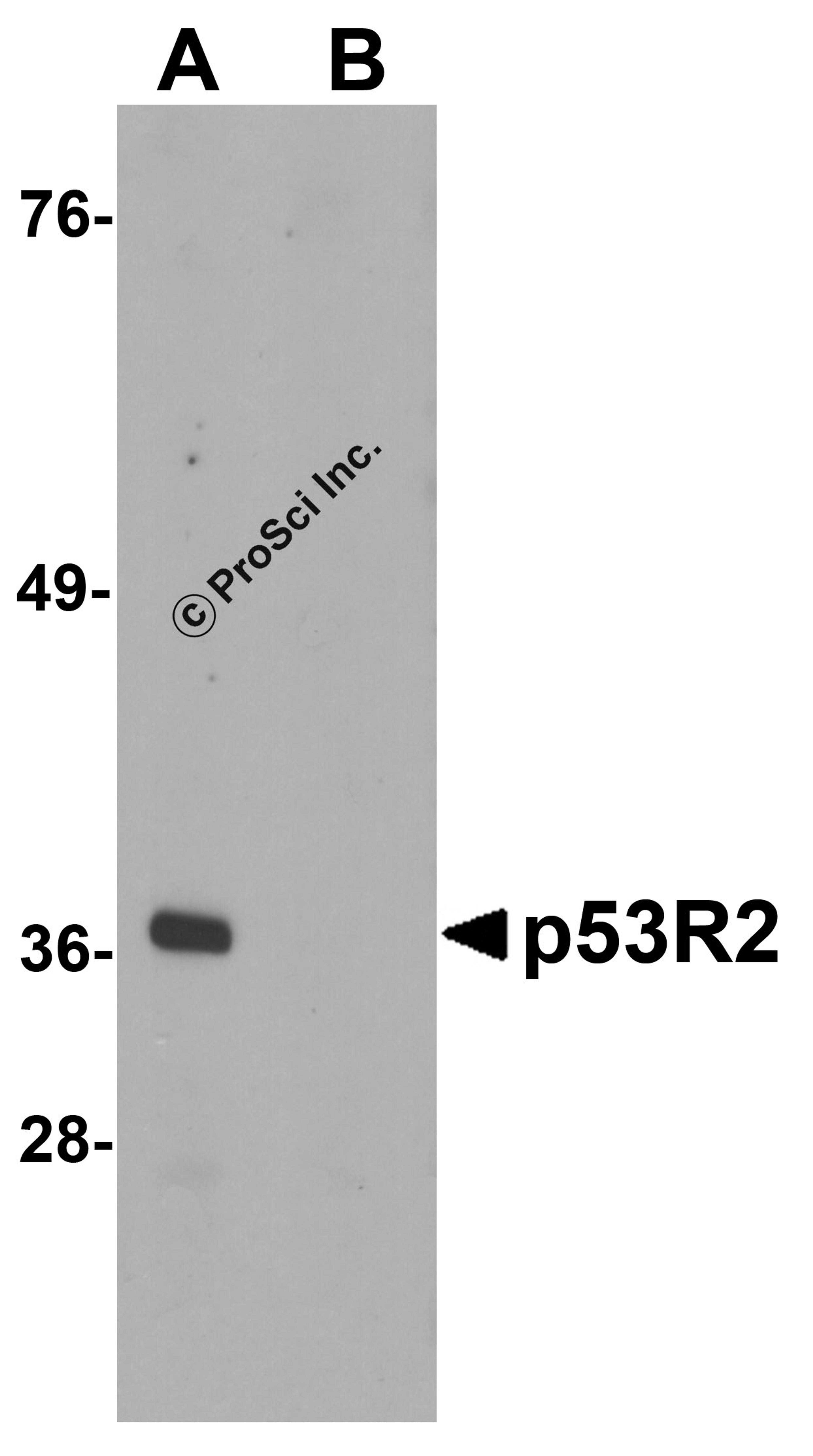 Western blot analysis of p53R2 in 3T3 cell lysate with p53R2 antibody at 1 μg/mL in (A) the absence and (B) the presence of blocking peptide.