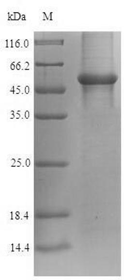 (Tris-Glycine gel) Discontinuous SDS-PAGE (reduced) with 5% enrichment gel and 15% separation gel.