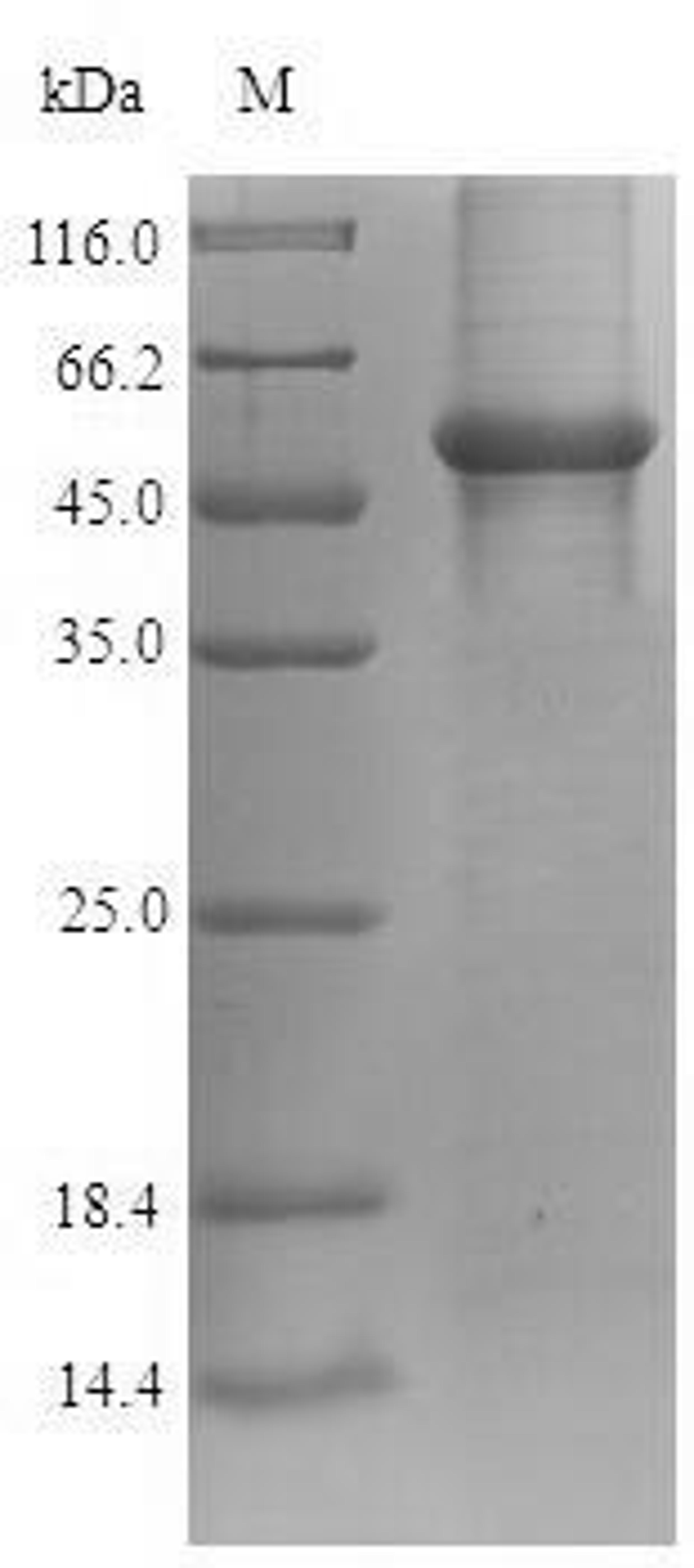 (Tris-Glycine gel) Discontinuous SDS-PAGE (reduced) with 5% enrichment gel and 15% separation gel.