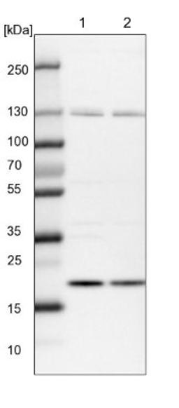 Western Blot: Ufc1 Antibody [NBP1-81676] - Lane 1: NIH-3T3 cell lysate (Mouse embryonic fibroblast cells)<br/>Lane 2: NBT-II cell lysate (Rat Wistar bladder tumour cells)