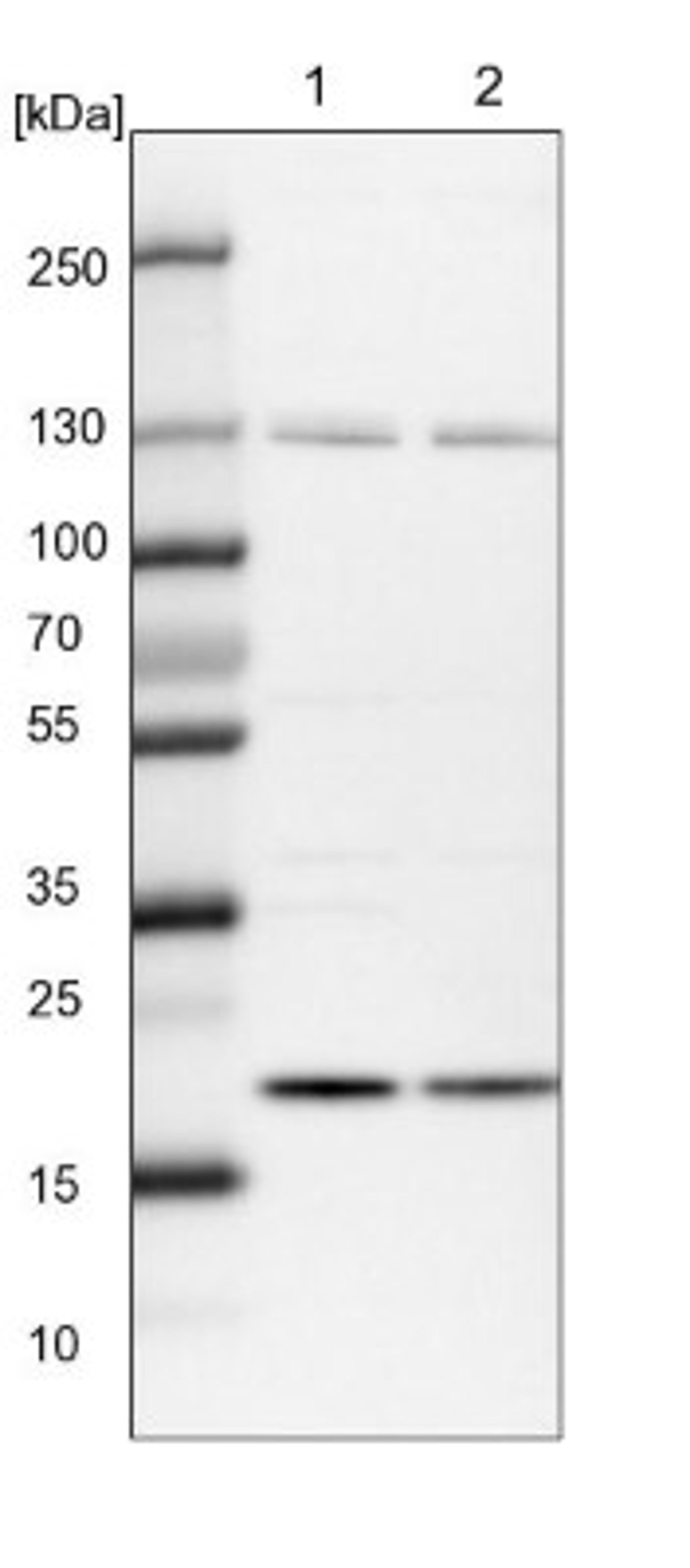 Western Blot: Ufc1 Antibody [NBP1-81676] - Lane 1: NIH-3T3 cell lysate (Mouse embryonic fibroblast cells)<br/>Lane 2: NBT-II cell lysate (Rat Wistar bladder tumour cells)