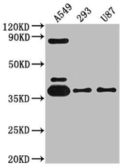 Western Blot. Positive WB detected in: A549 whole cell lysate, 293 whole cell lysate, U87 whole cell lysate. All lanes: ADORA1 antibody at 1:2000. Secondary. Goat polyclonal to rabbit IgG at 1/50000 dilution. Predicted band size: 37, 14 kDa. Observed band size: 37 kDa.