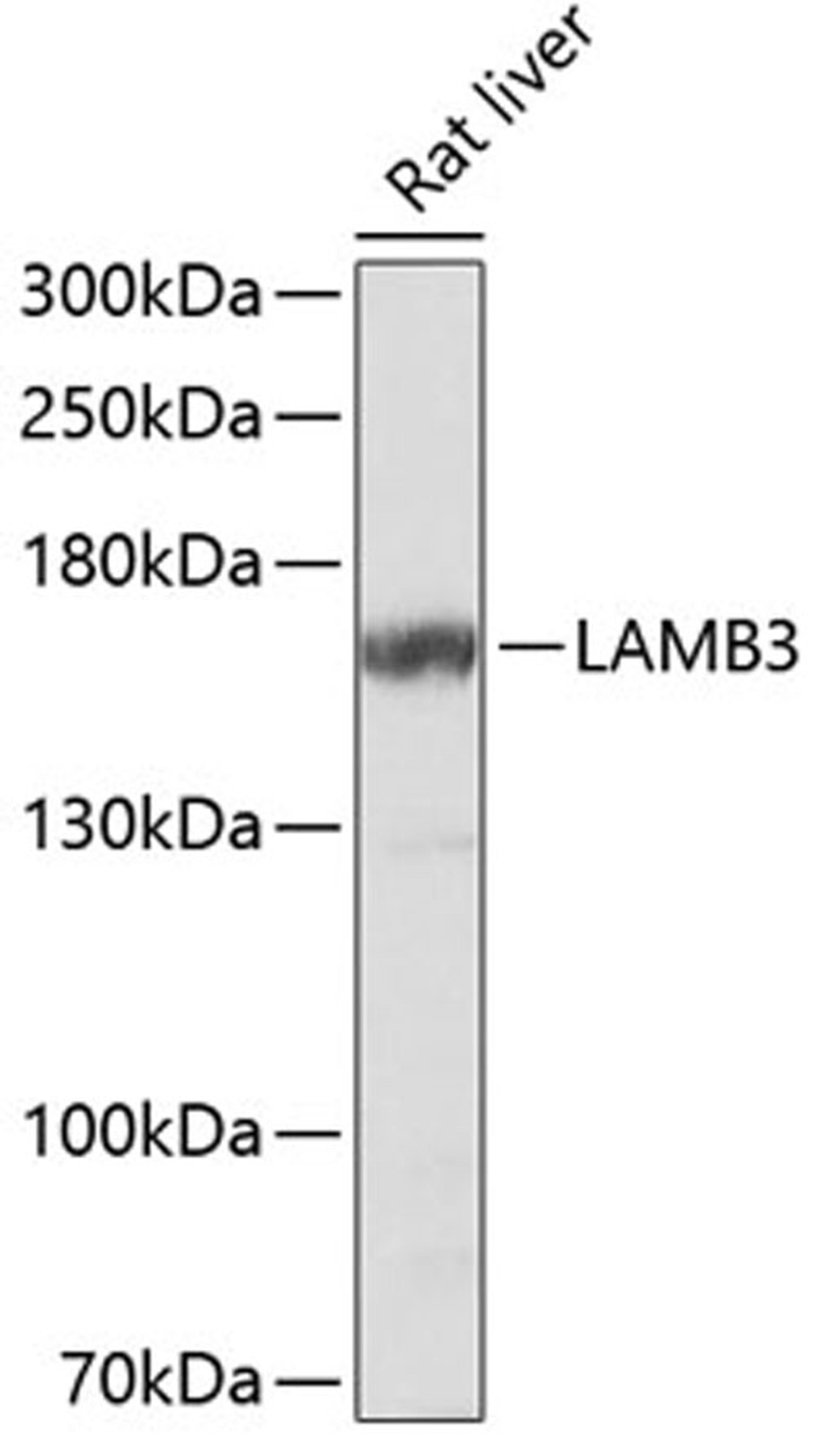 Western blot - LAMB3 Antibody (A13663)