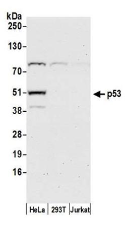 Detection of human p53 by western blot.