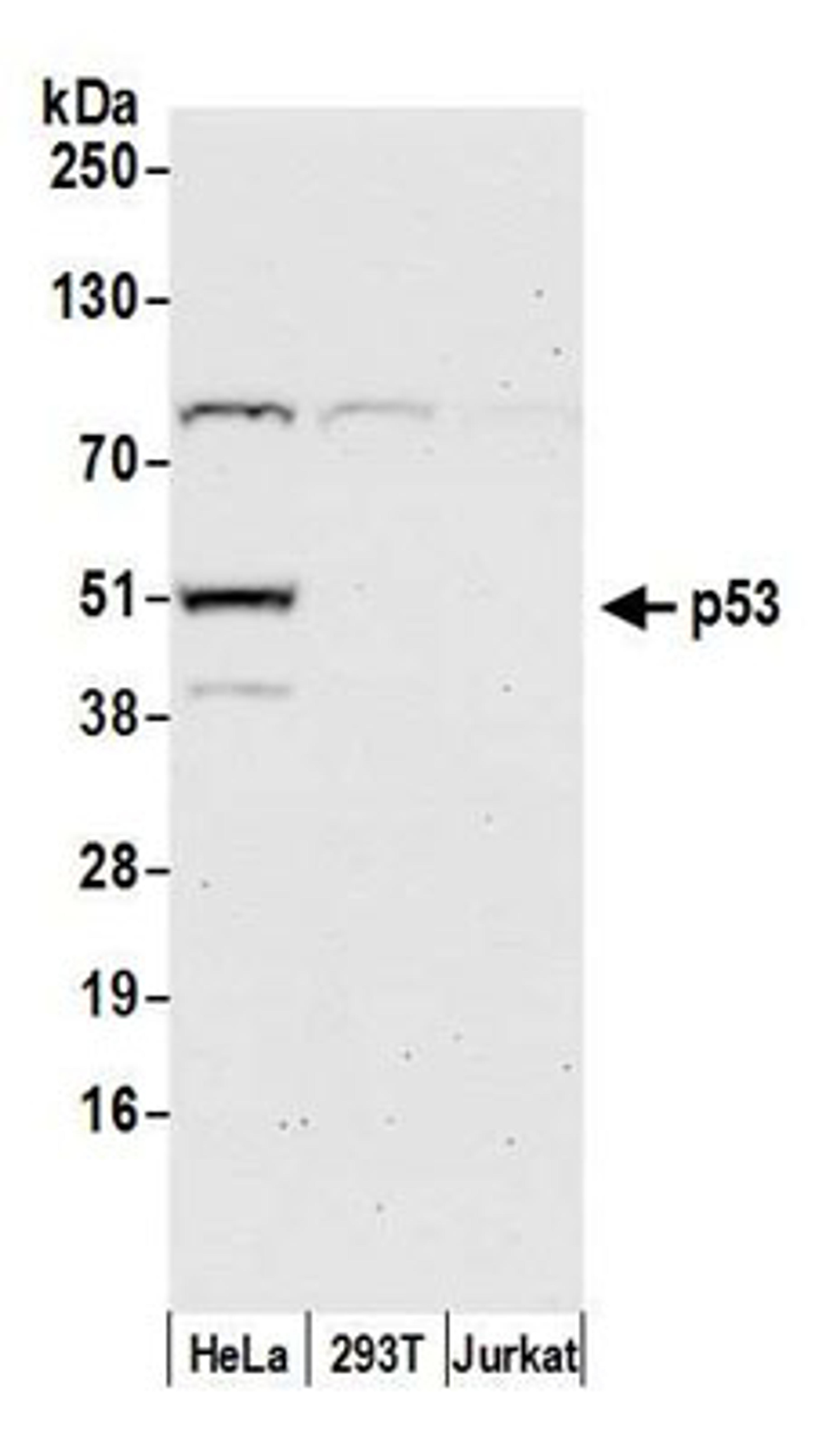 Detection of human p53 by western blot.