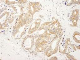 Detection of human DDX6 by immunohistochemistry.