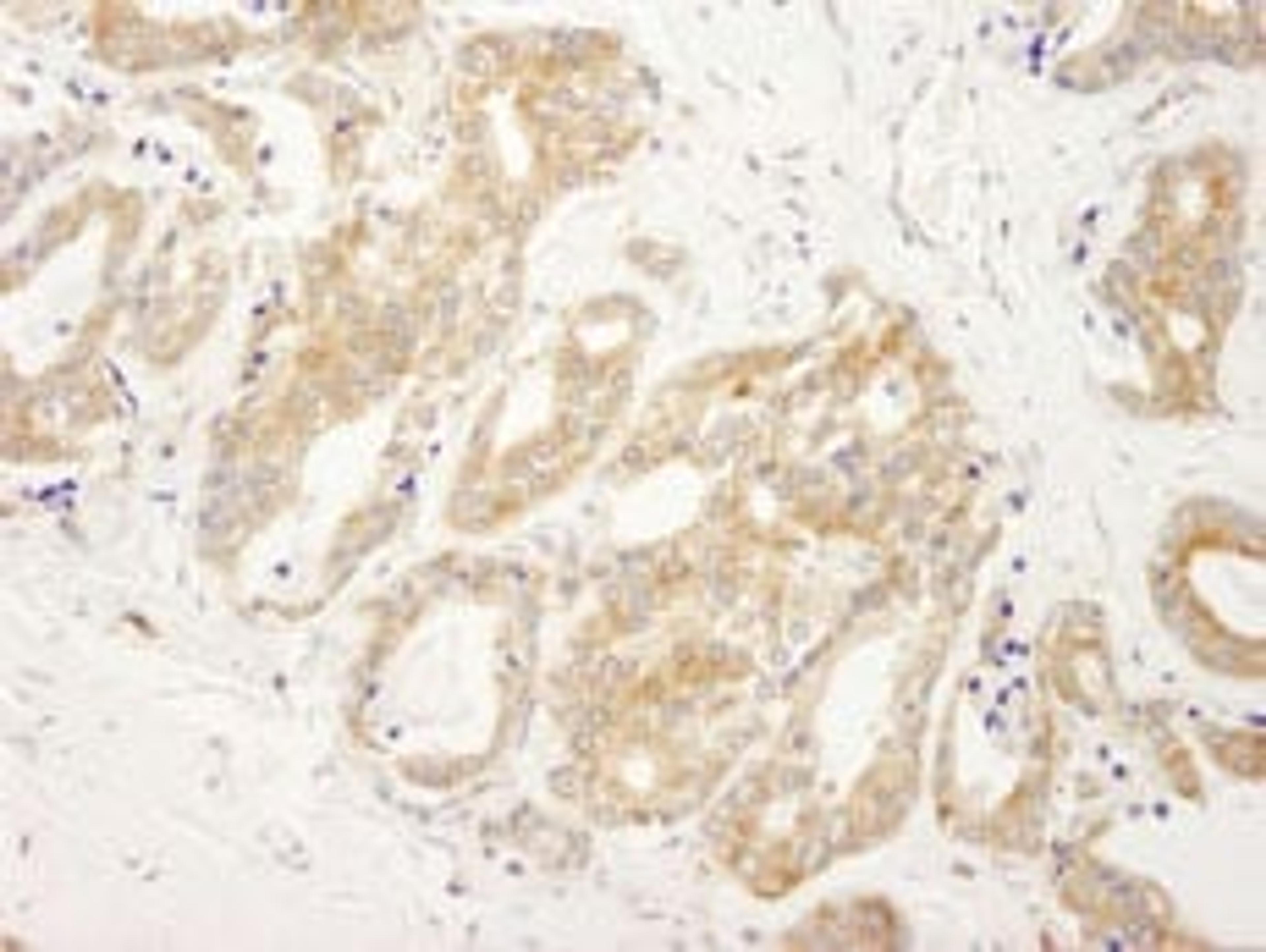 Detection of human DDX6 by immunohistochemistry.