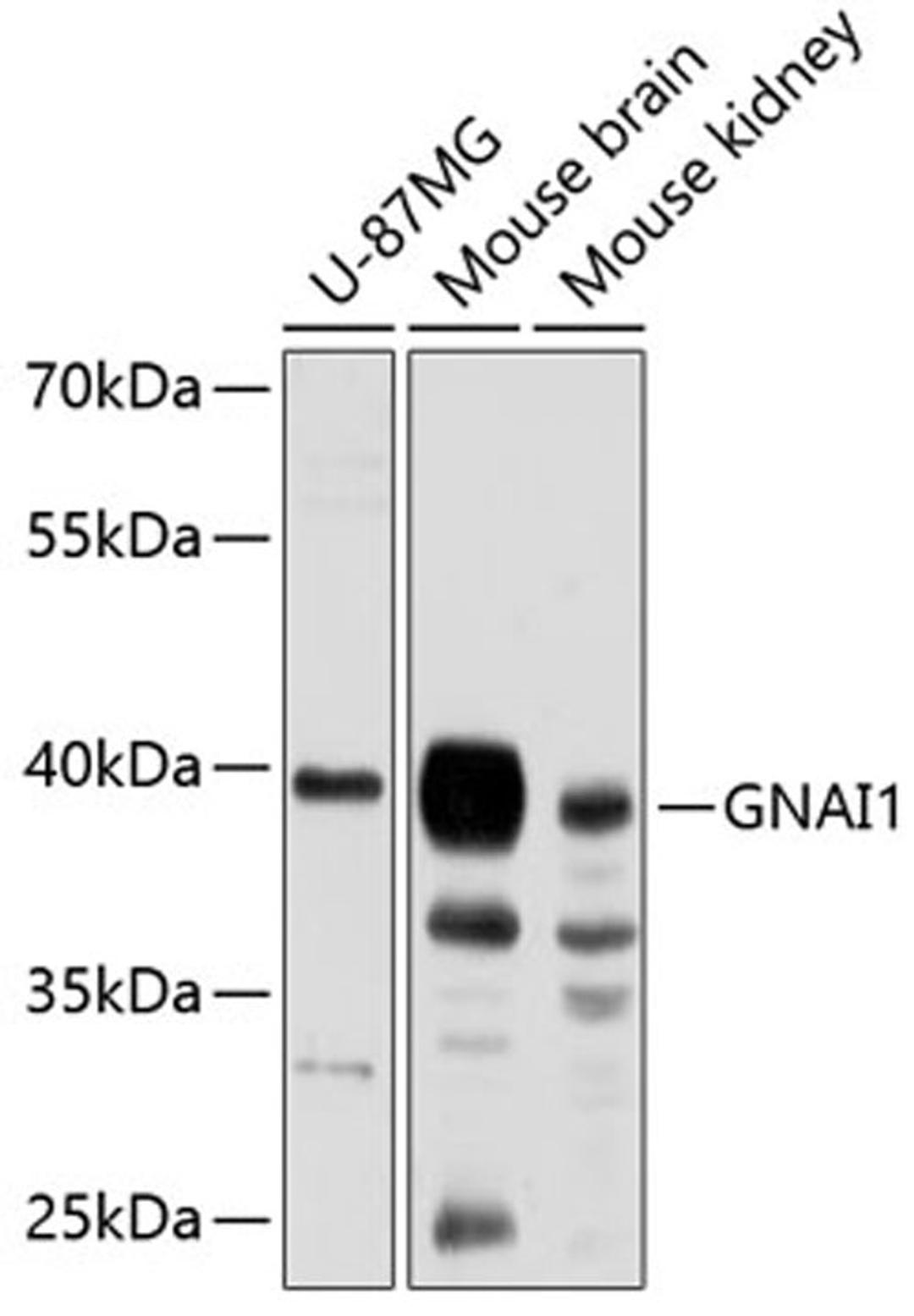 Western blot - GNAI1 antibody (A8844)