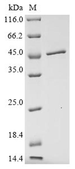 (Tris-Glycine gel) Discontinuous SDS-PAGE (reduced) with 5% enrichment gel and 15% separation gel.