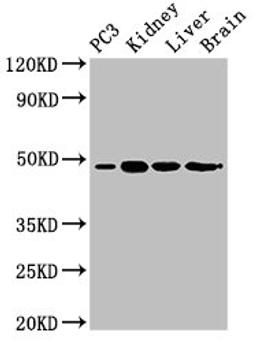 Western Blot. Positive WB detected in: PC-3 whole cell lysate, Mouse kidney tissue, Mouse liver tissue, Rat brain tissue. All lanes: ACP6 antibody at 3ug/ml. Secondary. Goat polyclonal to rabbit IgG at 1/50000 dilution. Predicted band size: 49, 31 kDa. Observed band size: 49 kDa.