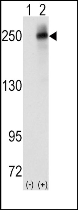 Western blot analysis of ALK using rabbit polyclonal ALK Antibody.293 cell lysates (2 ug/lane) either nontransfected (Lane 1) or transiently transfected with the ALK gene (Lane 2).