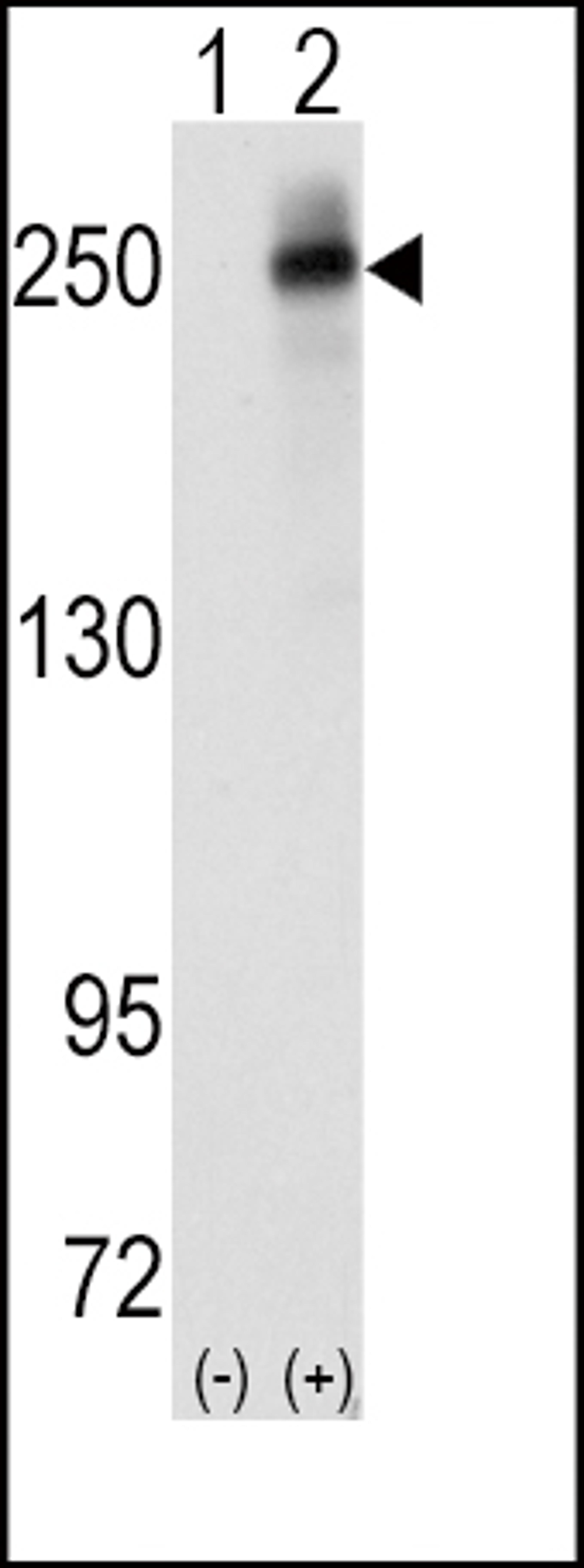 Western blot analysis of ALK using rabbit polyclonal ALK Antibody.293 cell lysates (2 ug/lane) either nontransfected (Lane 1) or transiently transfected with the ALK gene (Lane 2).